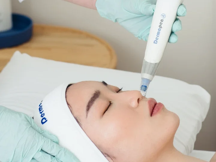 Séance microneedling avec le dermapen 4 pour traiter les problématiques de peaux. Microneedling professionnel DermaPen 4